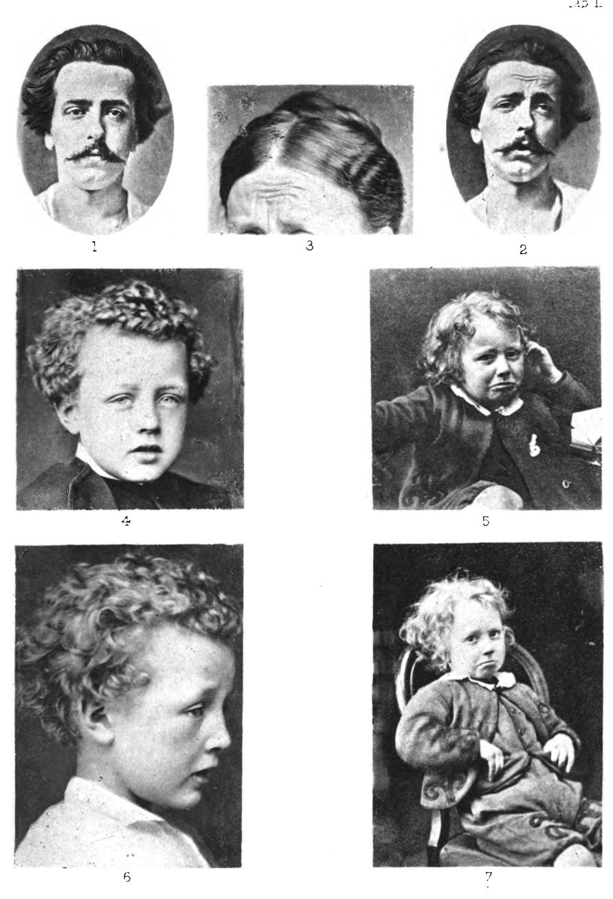 Obliquity of the Eyebrows. Plate II