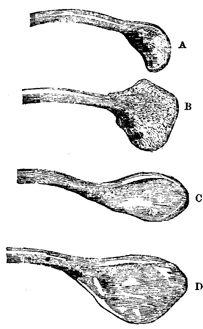 Fig. 38.--Extremities of the Furculæ of Fowls. Fig. 38.--Extremities of the Furculæ of Fowls.