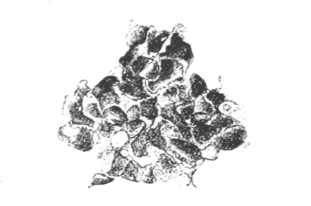 Fig. 31.—Part of the zoarium of Victorella bengalensis entirely transformed into resting buds, × 25. (From an aquarium in Calcutta.) Illustration: Fig. 31.—Part of the zoarium of Victorella bengalensis entirely transformed into resting buds, × 25. (From an aquarium in Calcutta.)