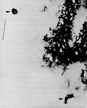 Figure 33.—Radiotagged wolf (upper left) found at kill (lower right). (Photo courtesy of L. D. Frenzel.) Figure 33.—Radiotagged wolf (upper left) found at kill (lower right). (Photo courtesy of L. D. Frenzel.)