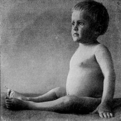 siehe Bildunterschrift siehe Bildunterschrift